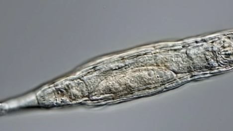 صورة مجهرية للروتيفير