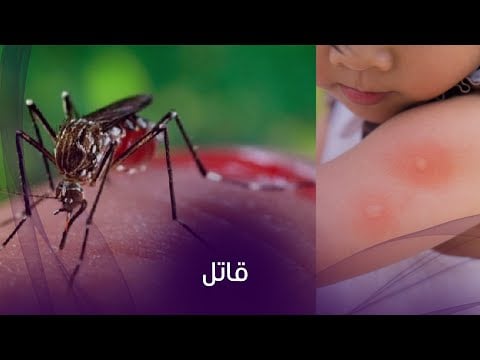 حمى الضنك