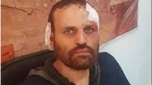 هشام عشماوي