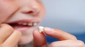 مأساة فتاة عشرينية تتعفن أسنانها وتتساقط باستمرار 