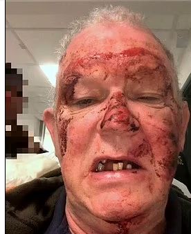 ملاكم يسحل مسن