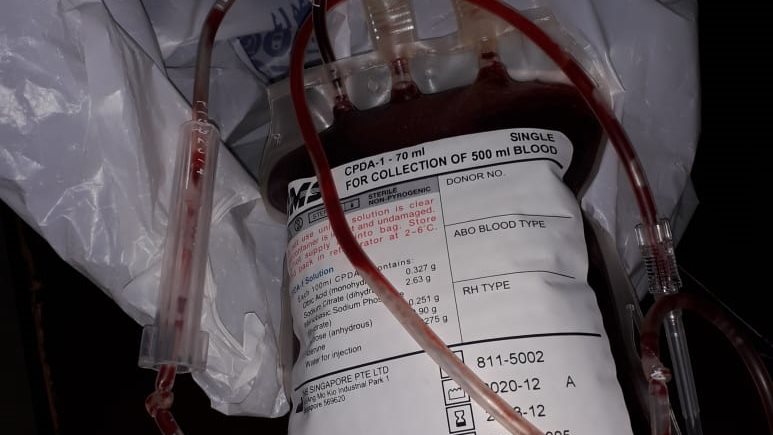 دم فاسد دم فاسد