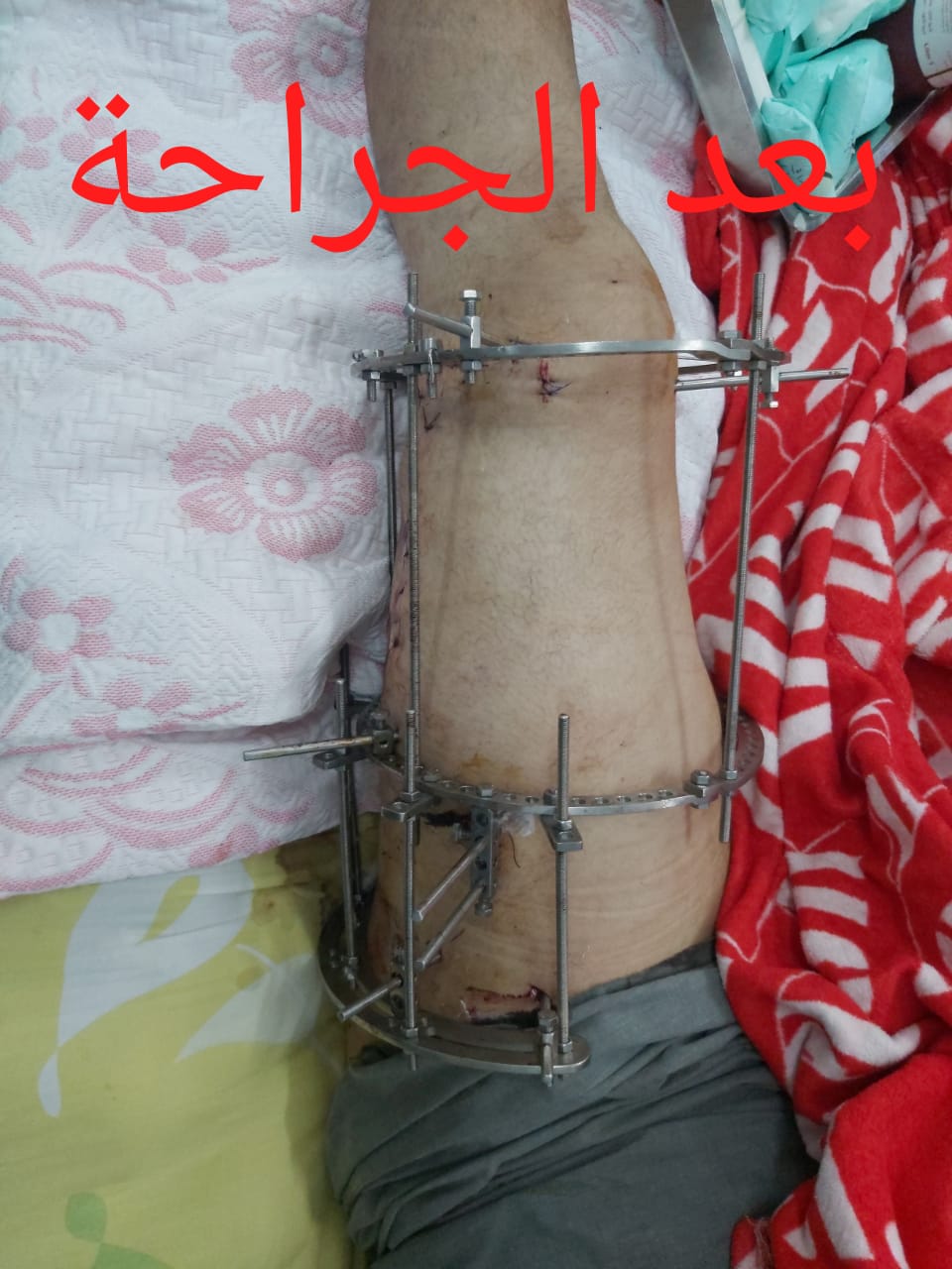 عملية بمستشفى شربين