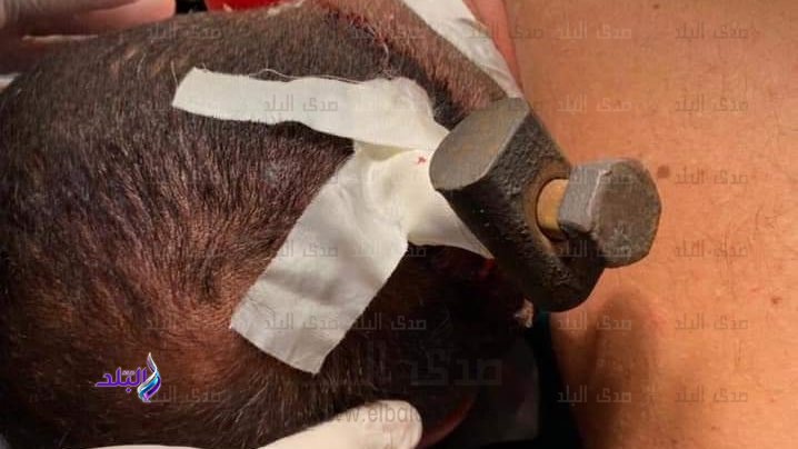 خلال العملية 
