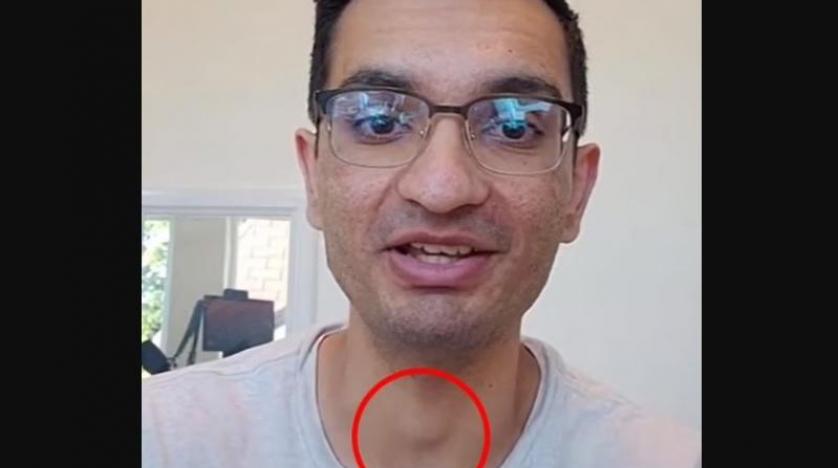 الرجل المصاب