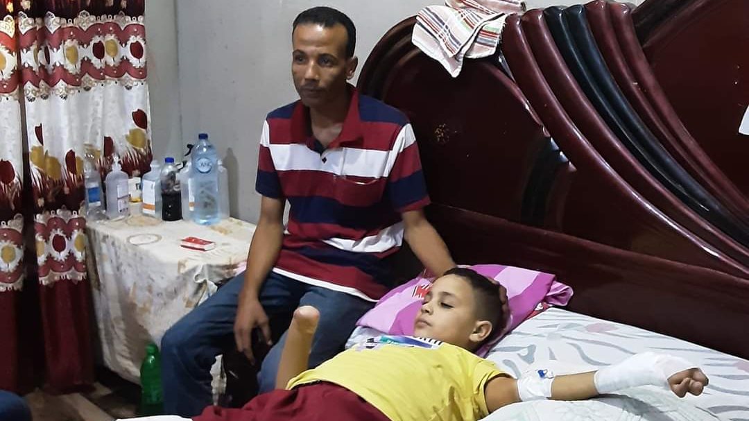 بالصور: الطفل"إسماعيل "ضحية البلطجة فقد طرفيه عقب سرقة توك ت