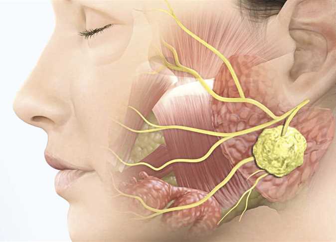 علاج العصب الخامس