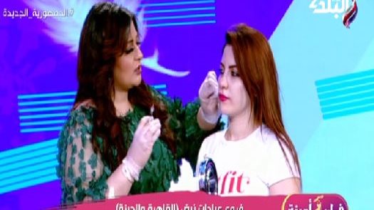 حقن الفيلر 