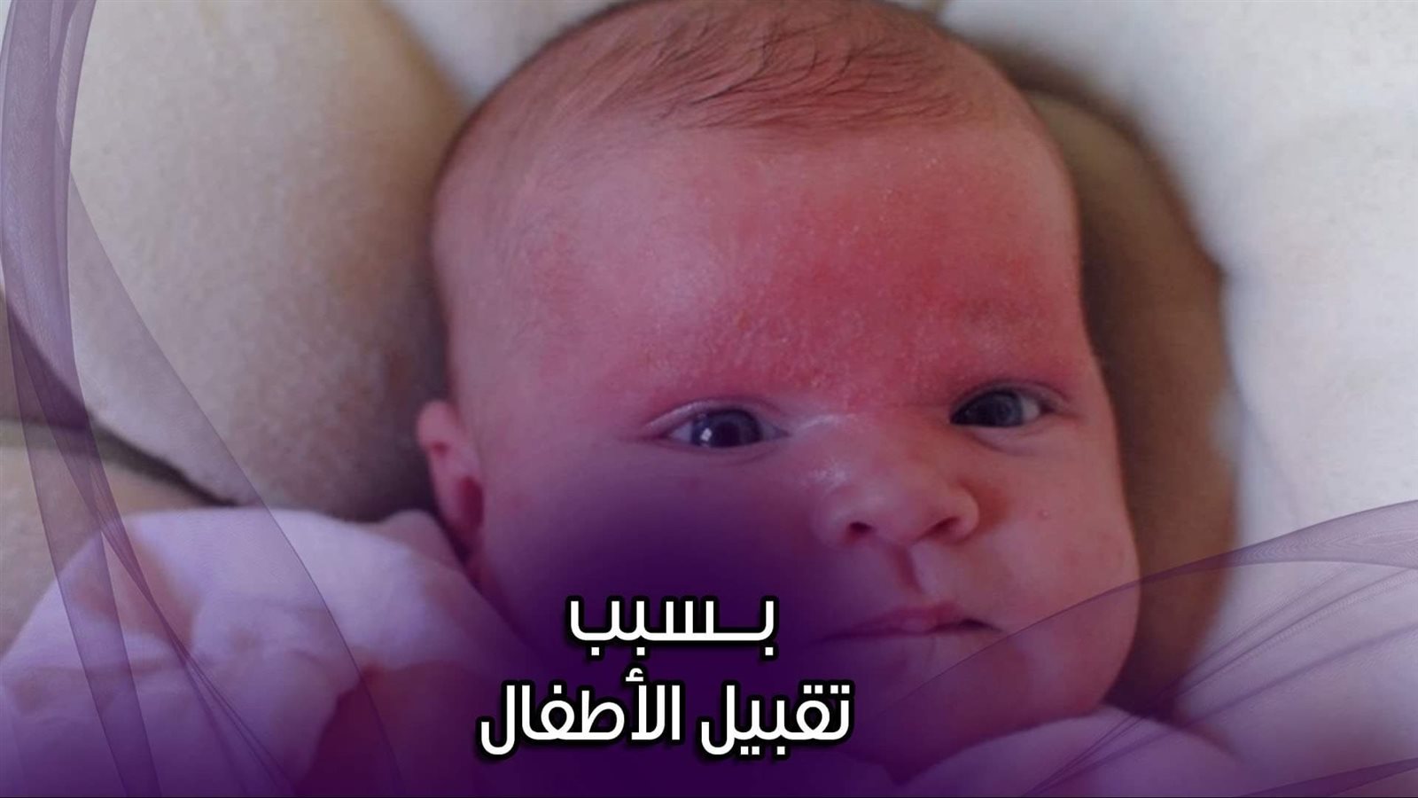 أعراض وعلاج الهربس