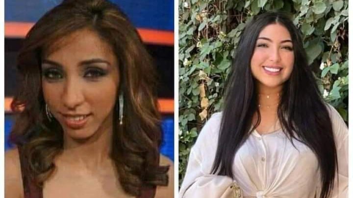 دنيا بطمة قبل وبعد 