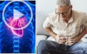 النوبة القلبية 