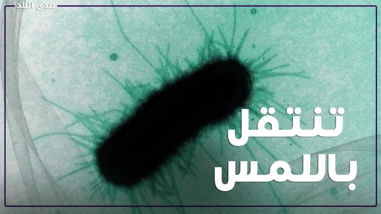 جرثومة تشيجيلا