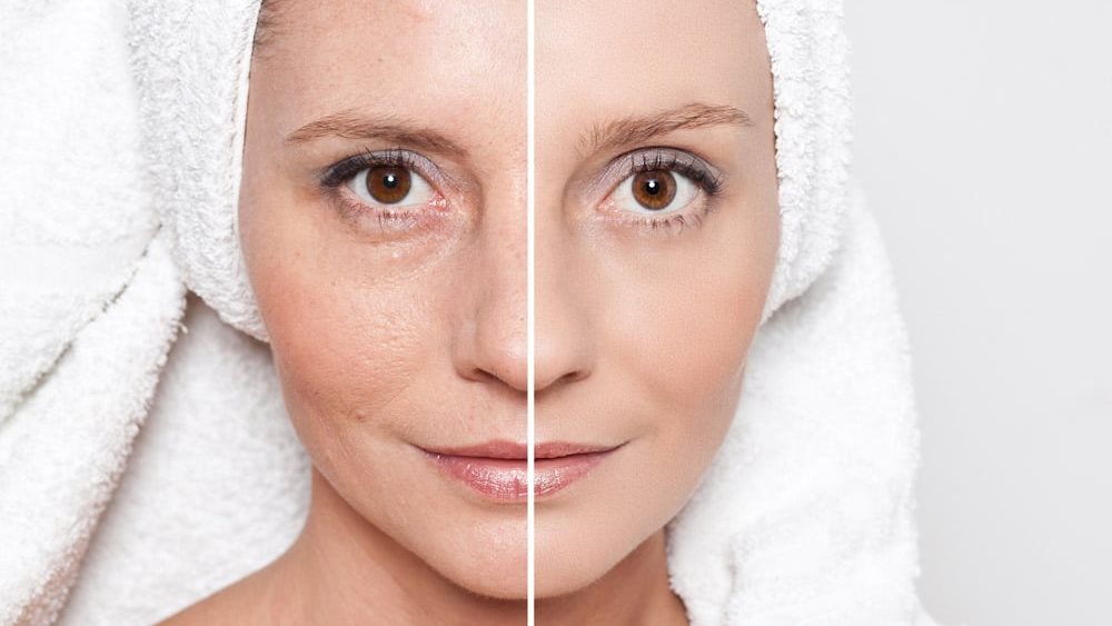 تحسين الجلد والبشرة