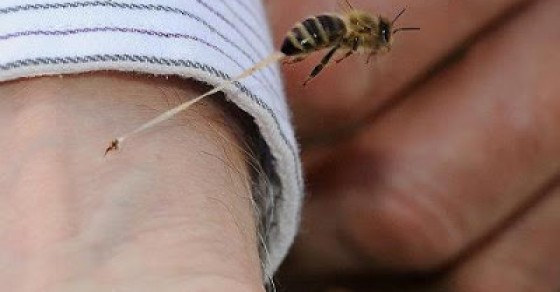 العلاج بالنحل 