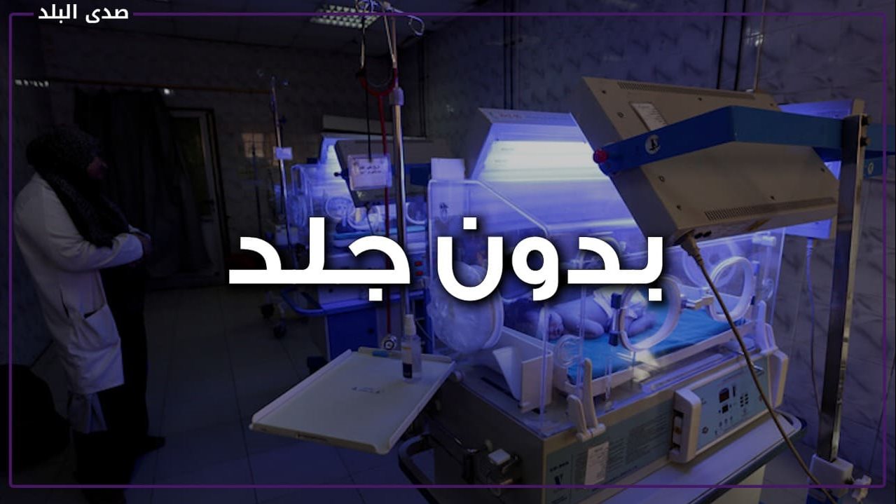 ولادات نادرة