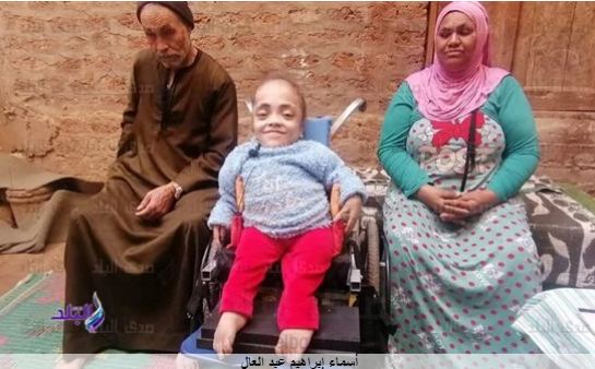 بعد إصابة الفتاة الزجاجية به ..." هشاشة العظام " ثلاث كسور  بعد إصابة الفتاة الزجاجية به ..." هشاشة العظام " ثلاث كسور
