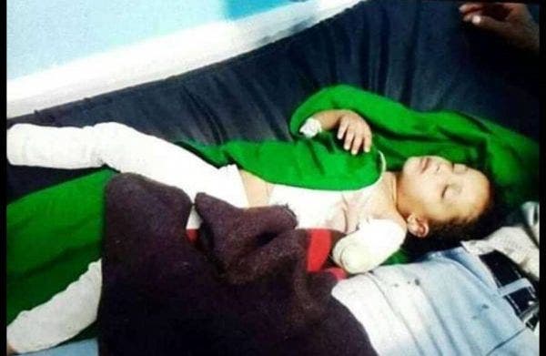 أسد يقضم يد طفلة بعمر عامين في اليمن