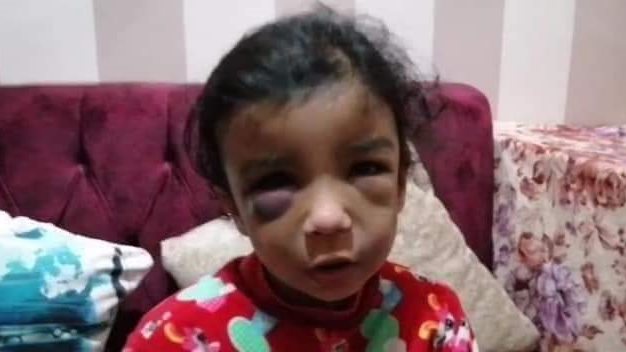 الطفلة رودينا