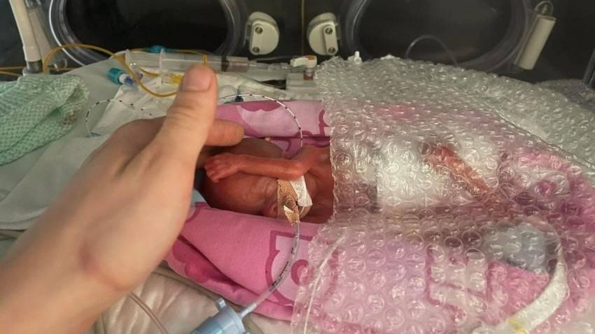 لن تتخيل وزنها.. أصغر مولودة في بريطانيا بصحة جيدة 