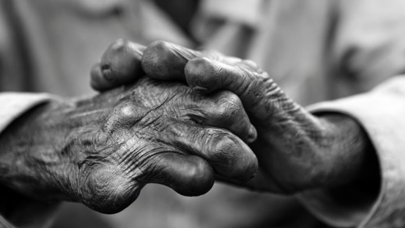 أرشيفية _ مريض جذام