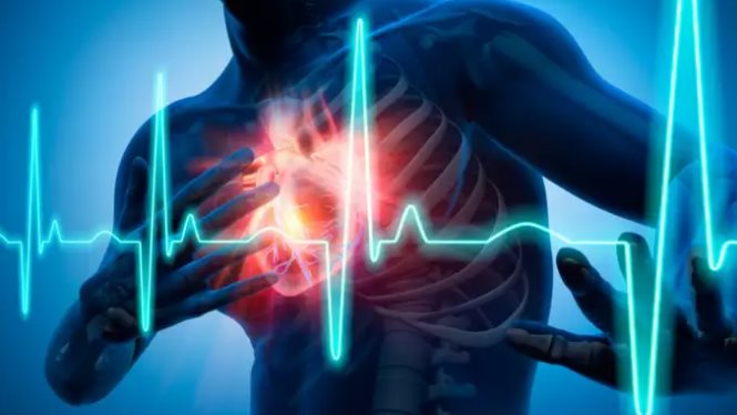 السكتة القلبية