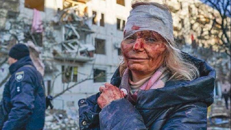 أوكرانية مصابة بشظايا قذيفة روسية