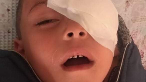 بلاغ من ولي أمر طالب ضد مدرسة حضانه خاصة بالمحلة لتعديها بال
