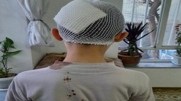 تفجير أكبر مساجد بـ كابول