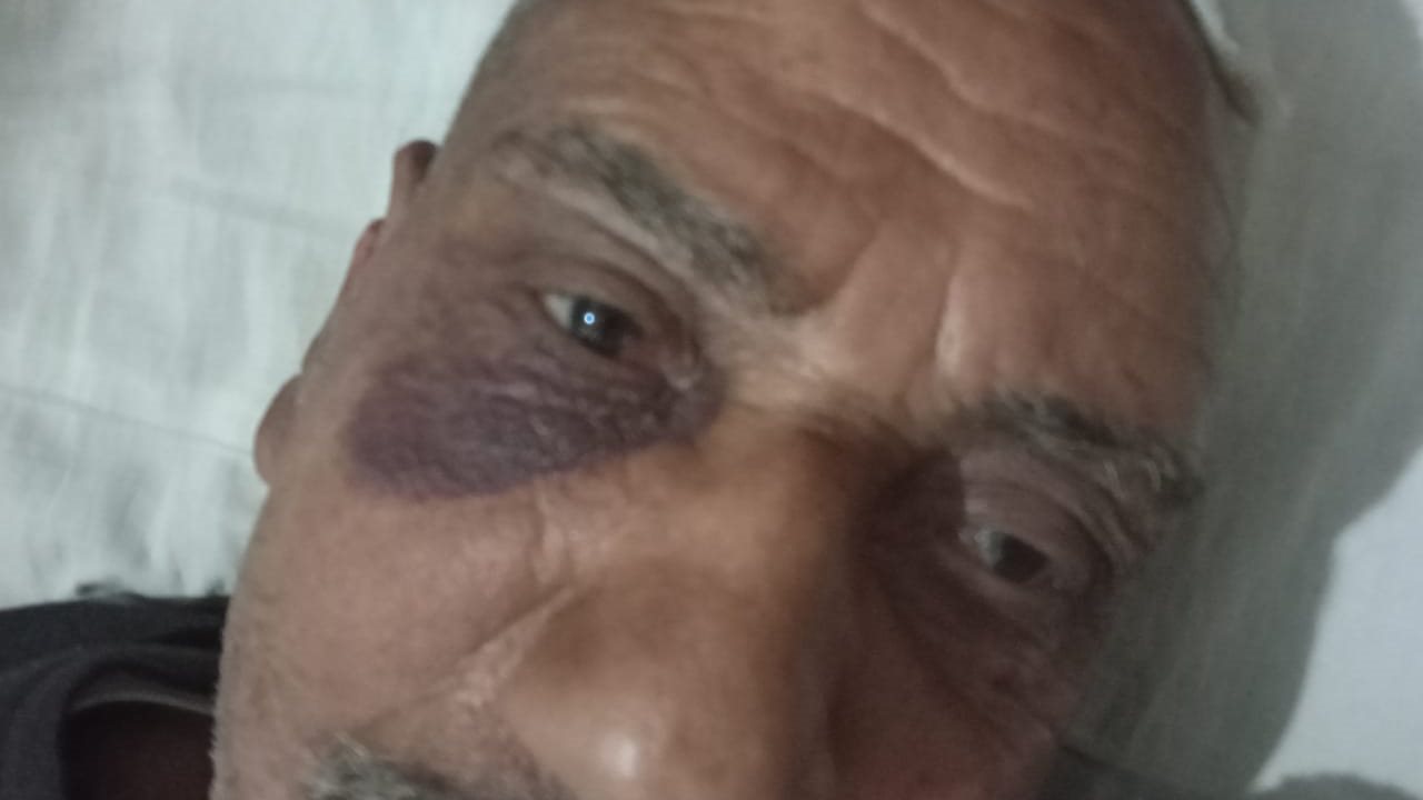 "قشرة موز" تشعل مشاجرة بالأسلحة البيضاء بين أشخاص بشوارع الم "قشرة موز" تشعل مشاجرة بالأسلحة البيضاء بين أشخاص بشوارع الم