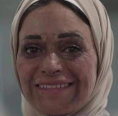 الناجيات من الحروق