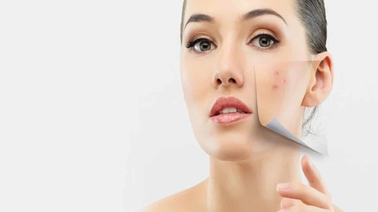  البقع الداكنة