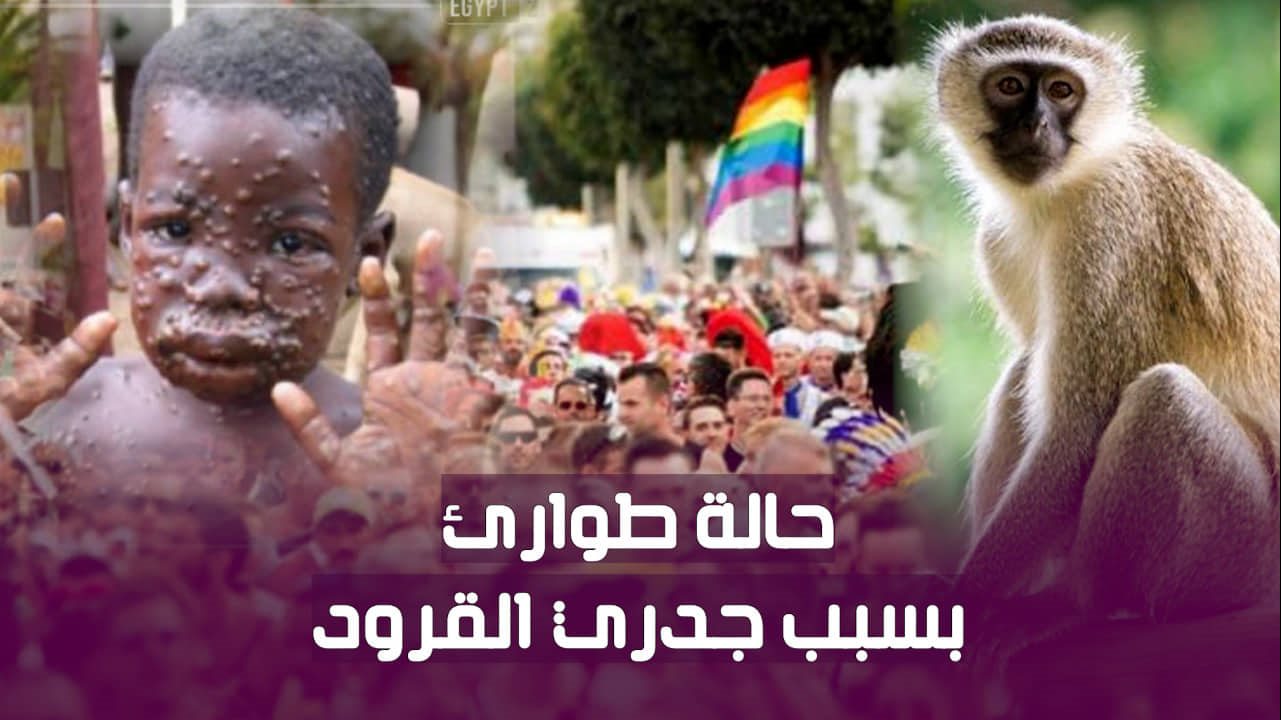 جدري القرود