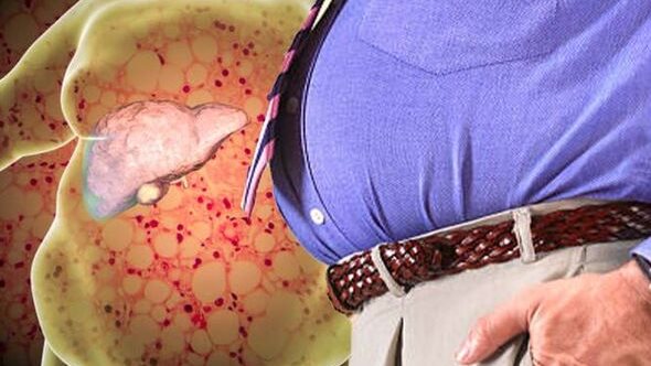 تورم المنطقة السفلية من البطن يكشف إصابتك بمرض خطير