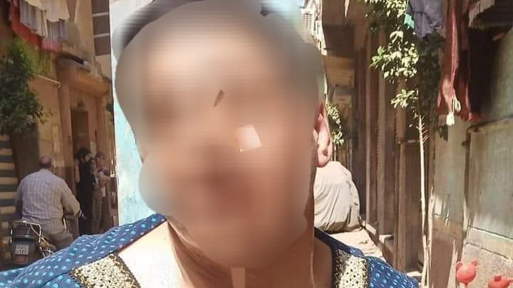 سيدة مصابة 