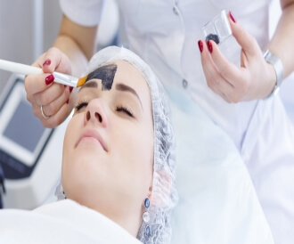 تقشير كيميائي