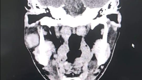الفريق الطبى بالبحيرة