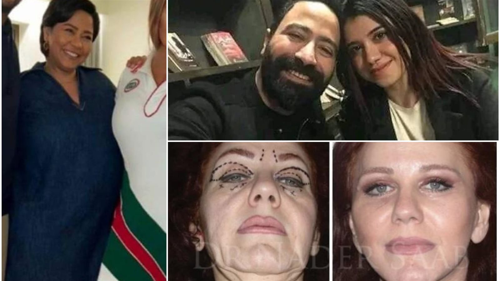 أخبار الفن