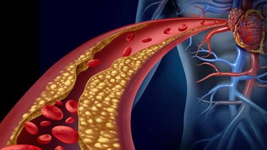 أطعمة تساهم في خفض نسبة الكوليسترول الضار