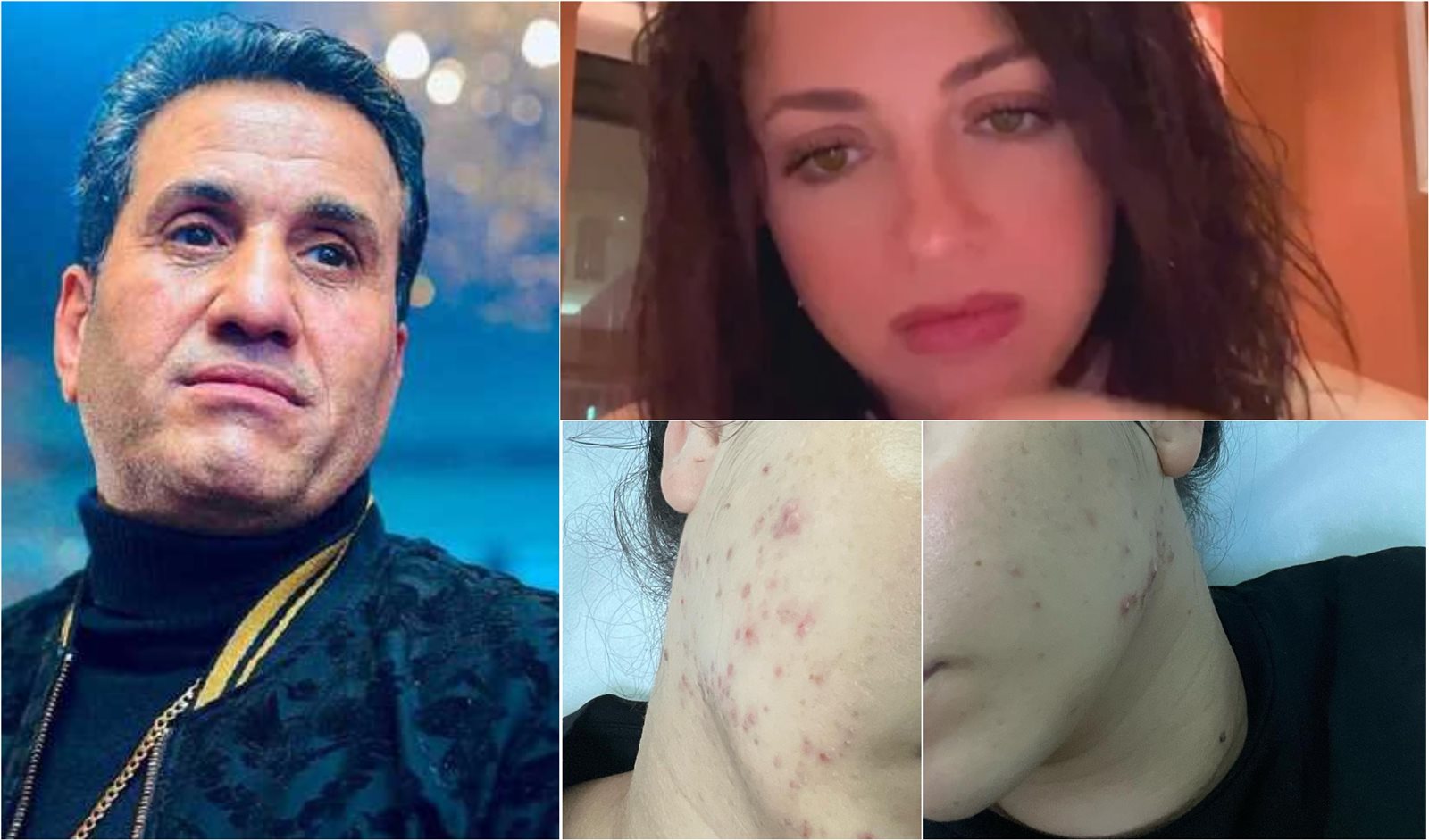 أخبار الفن