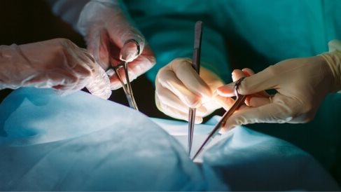 زراعة الأعضاء 