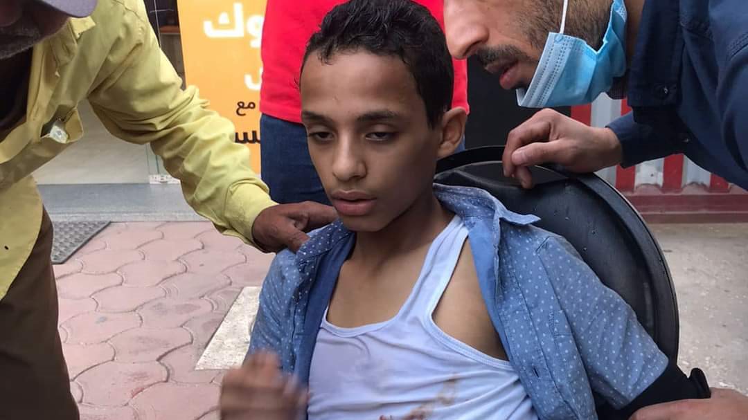 إصابة طفل بالغربية 