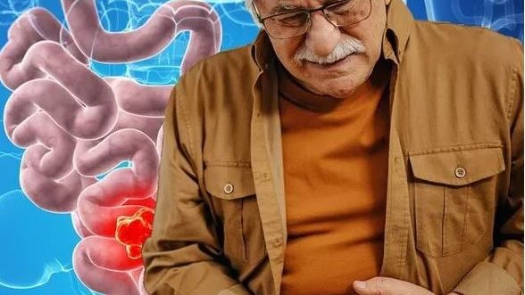 تحسين بكتيريا الامعاء