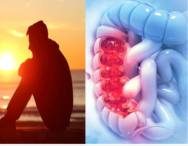 سرطان القولون