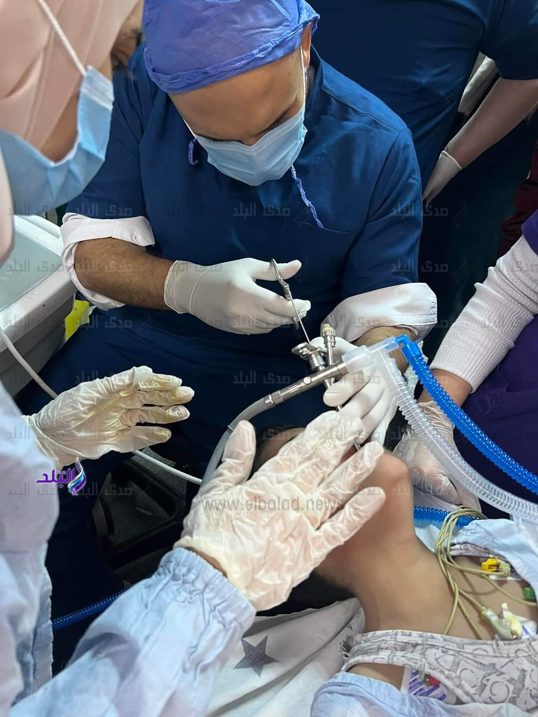 جانب من الجراحة