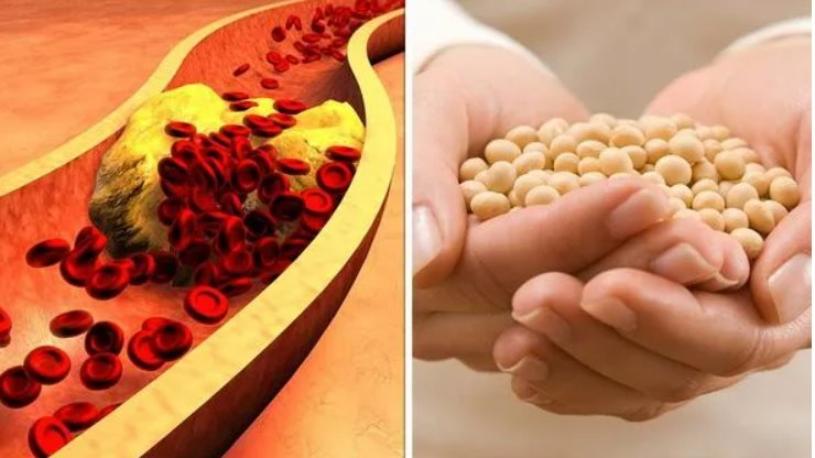 أطعمة تعالج الكوليسترول