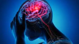  أعراض السكتة الدماغية