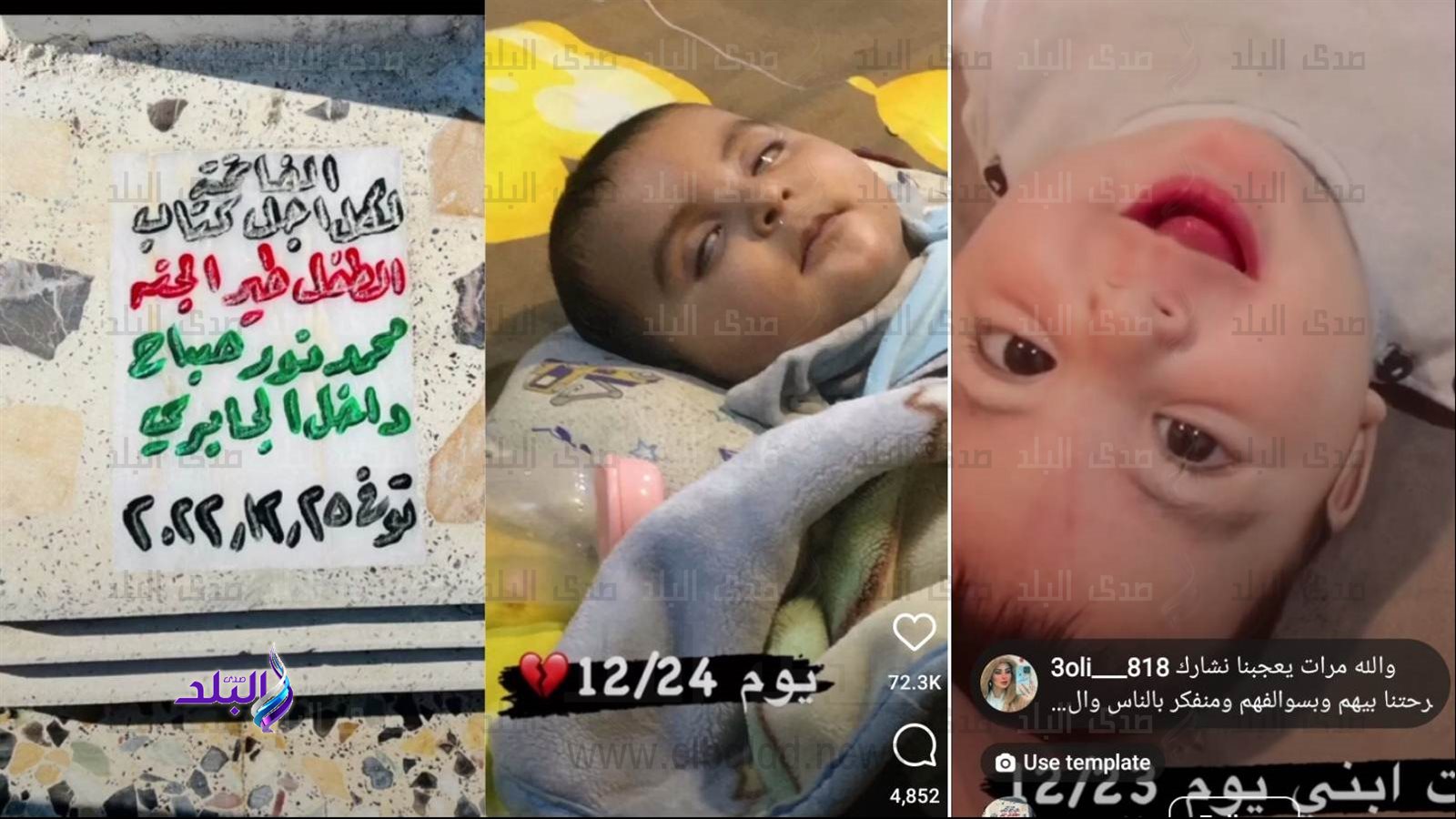 وفاة رضيع بعد نشر صورته على الإنترنت