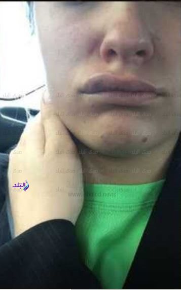 الفتاة الفرنسية لورا بريول