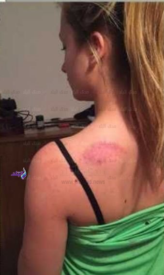 الفتاة الفرنسية لورا بريول