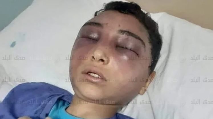 الطفل الضحية